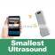 Portable Color Doppler WIFI Mini B&W Wireless Linear Probe for Ultrasound