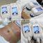 Cryotherapy Beauty For Slimming Body Cryo Liposhape Machine