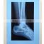 X-ray film the most popular China supper supplier standard medical film