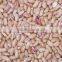 we are supply speckled Kidney Beans with good quality for sale