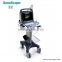 Sonoscape Portable Digital ultrasound machine color doppler