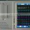 HC-H002 Top sell cheap Portable 3 Channel 12 leads ECG machine/electrocardiograph with 7 inch touch screen with analysis