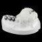 Full Metal Crown, FMC, FGC, Full Metal Post Core, Dental Crown, Cast Metal Crown, Dental Prosthesis, Laboratorio Dental, Dental Laboratory, Dentallabor, LJ Dental Lab China
