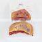 Medical breast disease model breast anatomical model medical training model breast feeding model