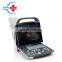 Original Mindray DP-20  ultrasound portable digital ultrasound system with super PW Doppler image