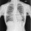 fuji dry film for agfa film from china for hospital china hot film