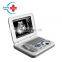 HC-A006 Black /white Laptop Ultrasound Scanner Linear Probe for Clinic Hospital Lab