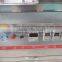Dry Type Onion Peeling machine, Onion Skin Removing Machine