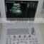 MY-A005 B Ultrasound Diagnostic System Hospital cheapest portable ultrasound machine