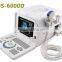 Cheapest Digital Portable Ultrasound Scanner RUS-6000D