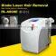 Best selling Laser Permanent 808nm Diode Laser Hair Removal Machine Price beauty machine device CE approved