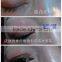spot removal machine , freckle removal machine $260/pcs ,without shipping
