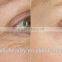 factory provide microneddle and fractional rf machine price for wrinkle fast removal and skin rejuvenation