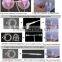 hot selling portable digital breast nipple enhancer machine