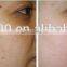 benign familial pemphigus treatment laser machine/co2 laser machine for surgical