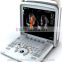MC-DU-Q8 High Class Portable OB/GYN 3D/4D Cardiac Color Doppler Ultrasound Scanner