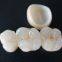 The zirconia crown is white and aesthetic.