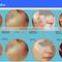 Sun Damage Recovery CO2 Fractional Laser Scar Eye Wrinkle / Bag Removal Removal/RF Tube Fractional CO2 LaCOser Beauty Equipment