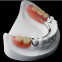 dental laboratory false teeth Chrome Cobalt titanium 3d metal printed partial dentures