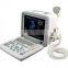 Portable Ultrasound Scanner With Convex Probe Transvaginal Micro-convex Rectal Probe Optional Video Printer