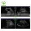 China Cheapest High Quality Pregnancy Portable Color Doppler Ultrasound Scanner, Medical 4D Portable Ultrasound Machine
