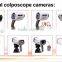 portable digital electronic colposcope with laptop