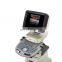 MY-A034C Digital Color Doppler Diagnostic Scanner with excellent quality