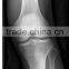 China raio x torax pelicula medical dry film KND-A/F CE