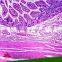 Various of Teaching Appliance Human Pathological Prepared Microslides