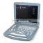 Portable/Laptop 15 inch LCD Color Doppler Ultrasound Diagnostic System RUS-9000-2