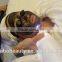 Mini Home use ND Yag Laser Tattoo Removal/Best Tattoo Removal Laser Equipment