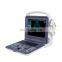 Portable 3D 4D Convex Scanner Color Doppler Ultrasound Machine for hospital