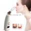 Hot compress blackhead remover face vacuum suction pen