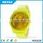 Unisex fashion plastic case leather watch straps wholesale