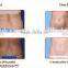 Maxbeauty beauty fat freezing machine 2016 trade assurance fat freezing weight loss machine