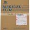 medical x-ray film blue sensitive 14*17inch
