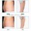 CE approved best effect 3 cryo applicators fat freeze body slimming machine CoolPlas