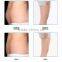 Medical use cryo body slimming lipolyse machine for fat freezing