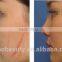 Skin Regeneration 2015 The New Technology Co2 Fractional Spot Scar Pigment Removal Warts Removal Laser Vaginal Tightening Machine Remove Neoplasms