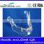 Hot Sale Transparant Mandibule Implant Model