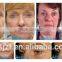 Forehead Wrinkle Removal HIFU-C 2016 Hifu Wrinkle Removal Machine Antiwrinkle Equipment Anti-aging