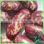 Best Long Red Speckled Kidney Beans