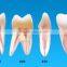 Tooth shaped items root canal model