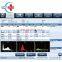 BC-30S mindray hematology fully automated hematology analyzer blood cell counter