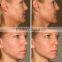 Ultrasonic Face Lift Skin Whiten High Intensity Focused Ultrasound Hifu Lifting Anti-aging Hifu Beauty Machine Painless