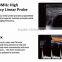 medical Chison portable 4d color ultrasound Chison q9