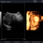 Premium 4D Color Doppler Ultrasound Scanner