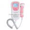 CE Fetal Heart Doppler LCD Pocket Prenatal Heart Baby Sound Monitor 3MHz Probe