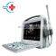 HC-A013 Portable Laptop color doppler ultrasound scanner machine price
