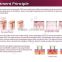 Vertical type 3 in 1 alexandrite laser best shr ipl machine hair removal for skin rejuvenation